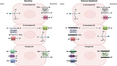 Metabolic alkalosis in cystic fibrosis: from vascular volume depletion to impaired bicarbonate excretion